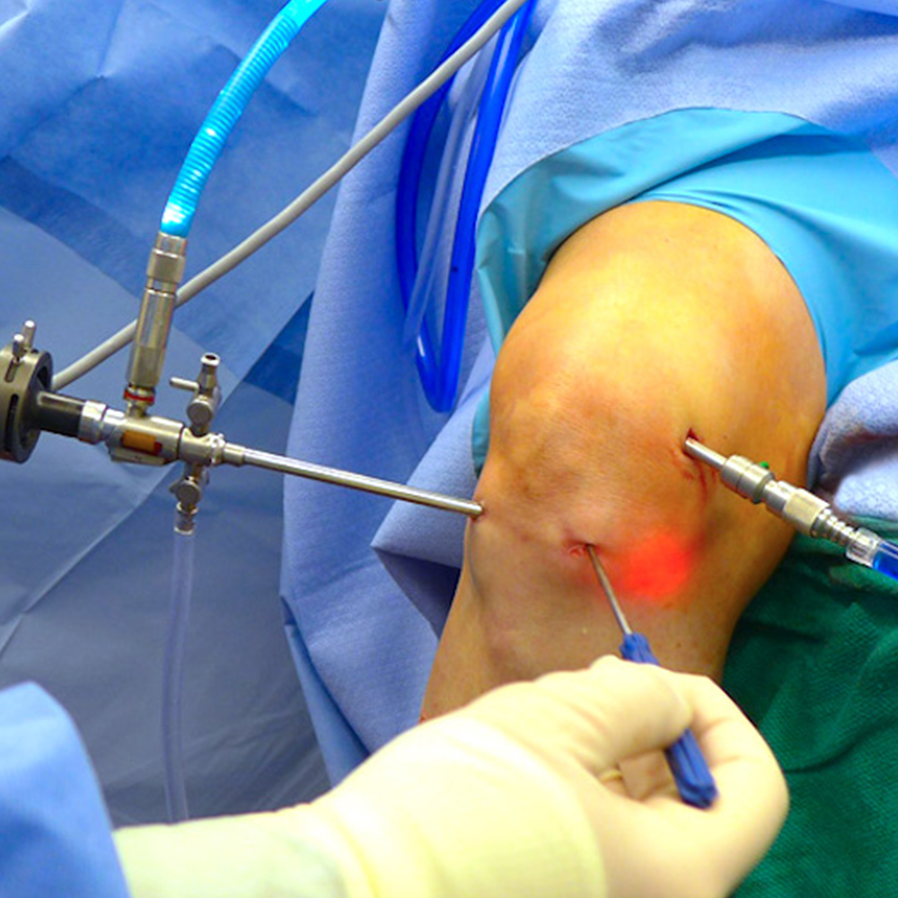 Minimally invasive surgery on shoulder and knee